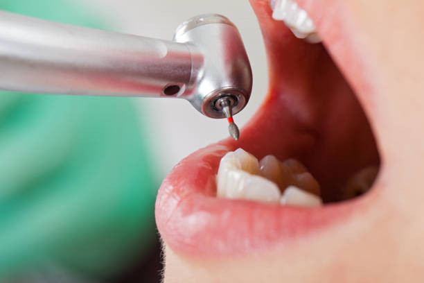 Best Pediatric Emergency Dentist in North Tonawanda, NY